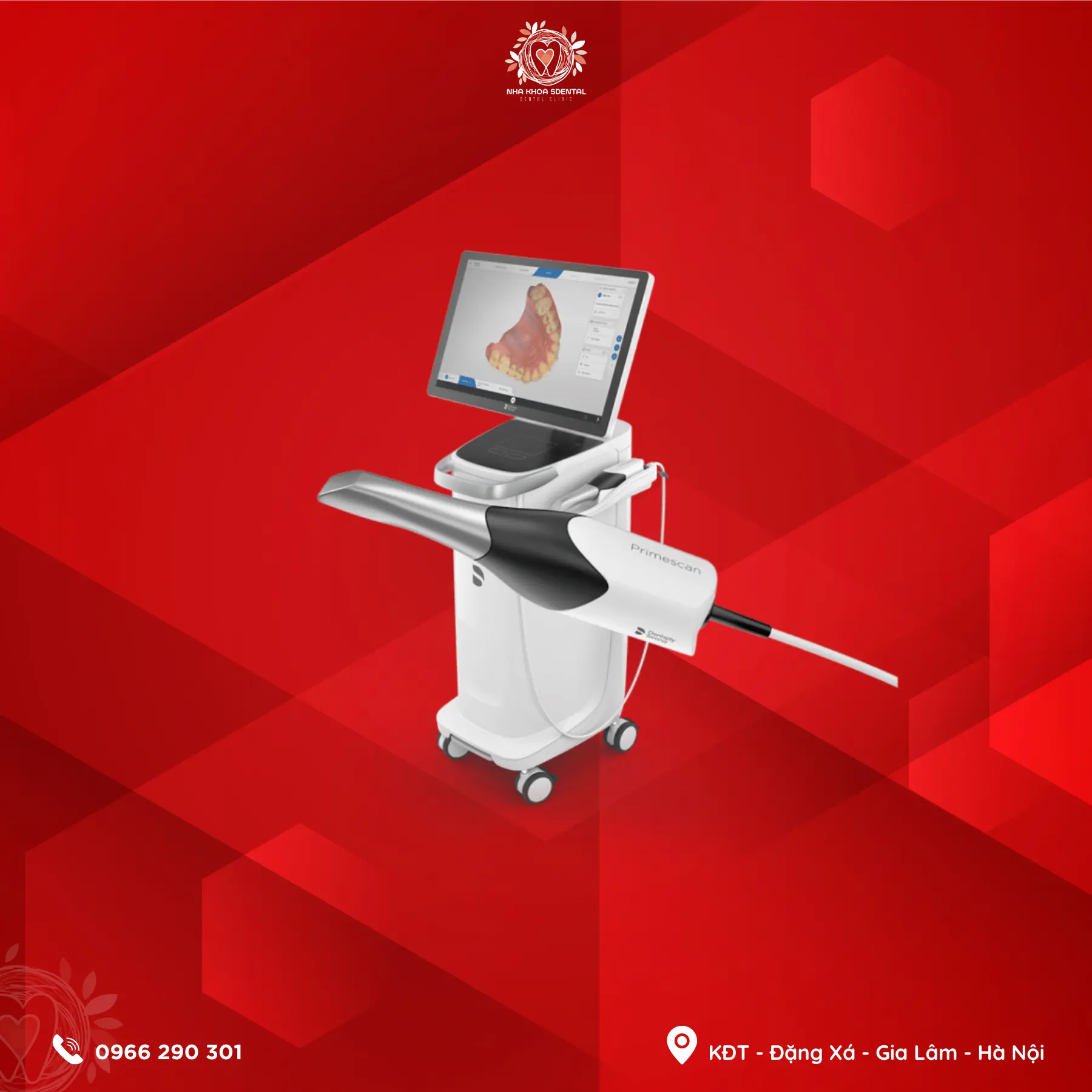 Intraoral Scanner