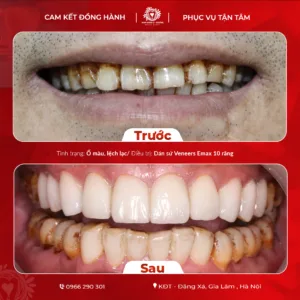 Artboard-1-copy-3-4-300x300.png