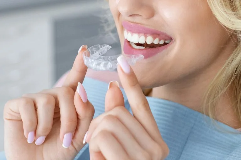 deoinvisialign-768x512.jpg