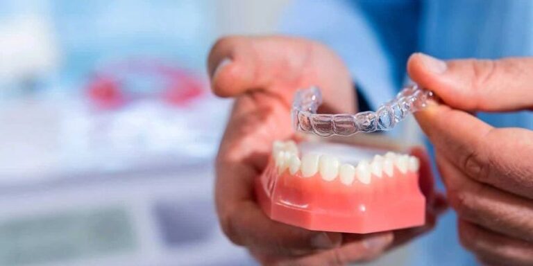 invisalign-768x384
