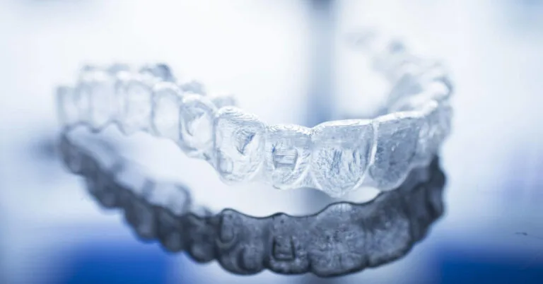 invisalign1-768x402.jpg