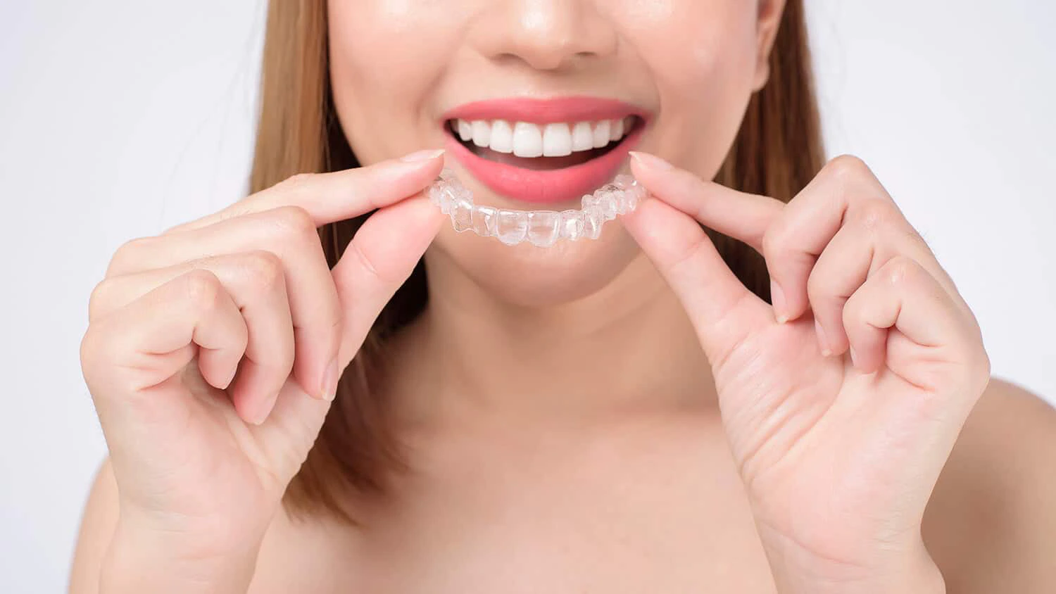 Niềng Răng Trong Suốt Clear Aligner Gần Đây Ở Gia Lâm: Tìm Kiếm Nhanh, Chọn Lựa Đúng