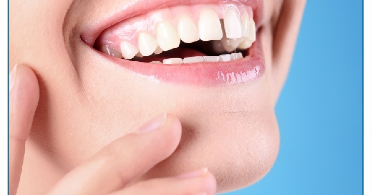 Niềng Răng Thưa Trọn Gói Ở Gia Lâm: An Tâm Chi Phí, Tối Ưu Hiệu Quả
