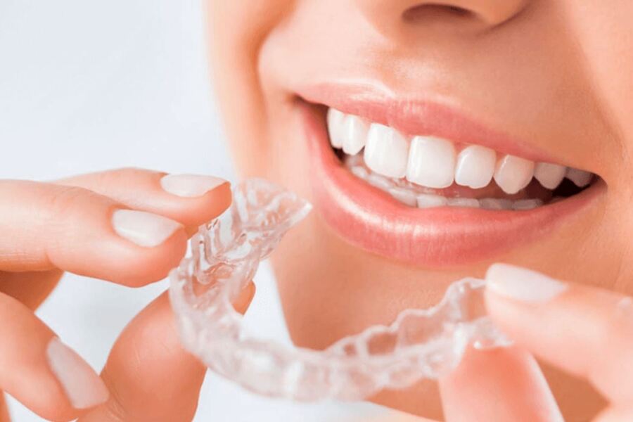 Nha Khoa Niềng Răng Trong Suốt Clear Aligner Ở Gia Lâm: Lựa Chọn Hiện Đại