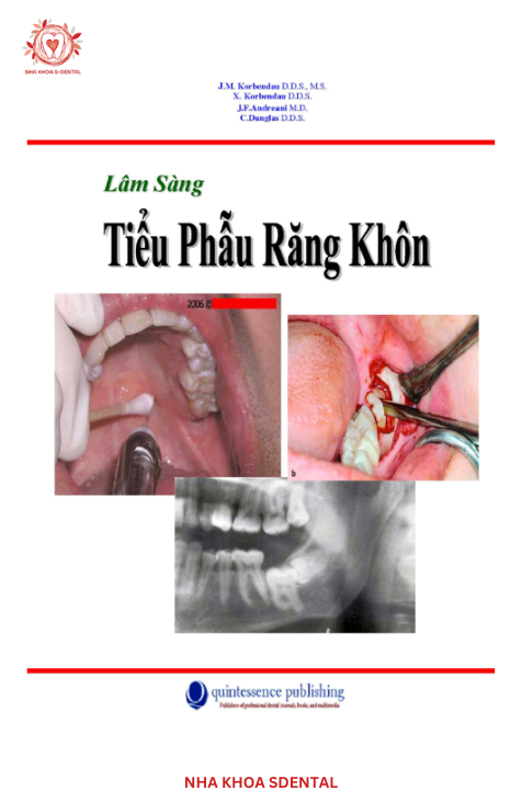 LÂM SÀNG TIỂU PHẪU RĂNG KHÔN: Cẩm Nang "Vàng" Cho Nha Sĩ