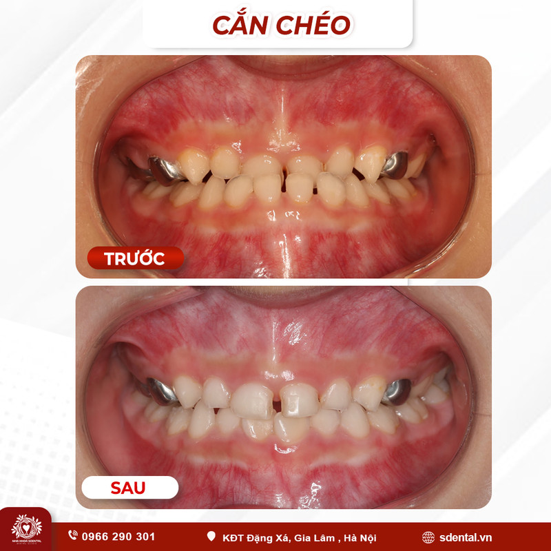 can-cheo-03